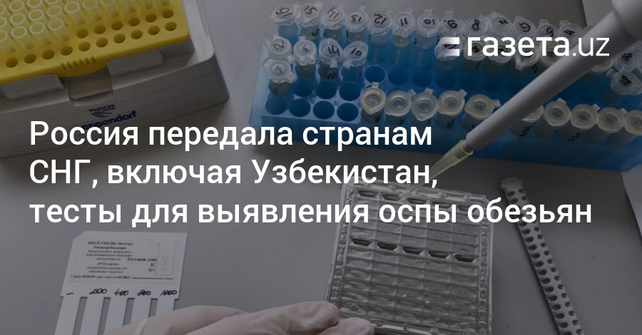 Тест ташкент. Тест на коронавирус. Россия передала тест-системы на выявление оспы обезьян Узбекистану. ВИЧ Роспотребнадзор. Результат теста на Covid-19 методом ПЦР.